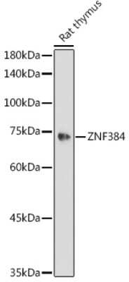 Western Blot: ZNF384 AntibodyAzide and BSA Free [NBP2-94454]